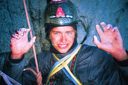 Leo Houlding - Leo Houlding after the 20m fall on Cerro Torre, 2002 Patagonia