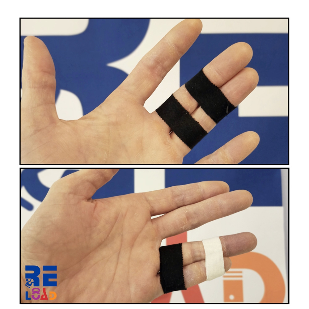 Arrampicata, infortuni, prevenzione