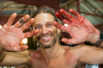 Damai Sentosa, Dragon's Horns, Malaysia - David Kaszlikowski after a machete accident. The team cut a new access trail through the jungle.