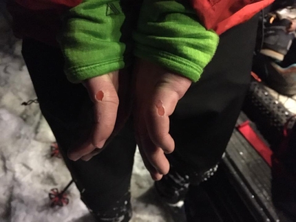 Greg Boswell, Scott Grosdanof, Coire an Lochain, Cairngorms, Scotland - Greg Boswell's hands after the first ascent of 'Intravenous Fly Trap' at Coire an Lochain in the Cairngorms, Scotland
