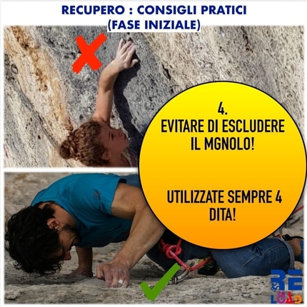 Arrampicata, infortuni, prevenzione - Arrampicata, infortuni, prevenzione: se il dolore lo consente si può continuare ad arrampicare, ma bisogna utilizzare sempre le quattro dita, evitando l'arrampicata su buchi o prese che escludano il mignolo e l'anulare in modo da non sollecitare ulteriormente le strutture coinvolte